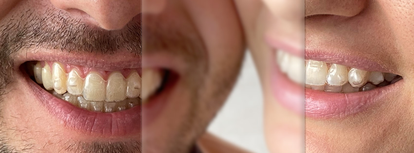 COVER-ZIBAR.jpg_WEB Ortho-Rijeka, Ortodoncija