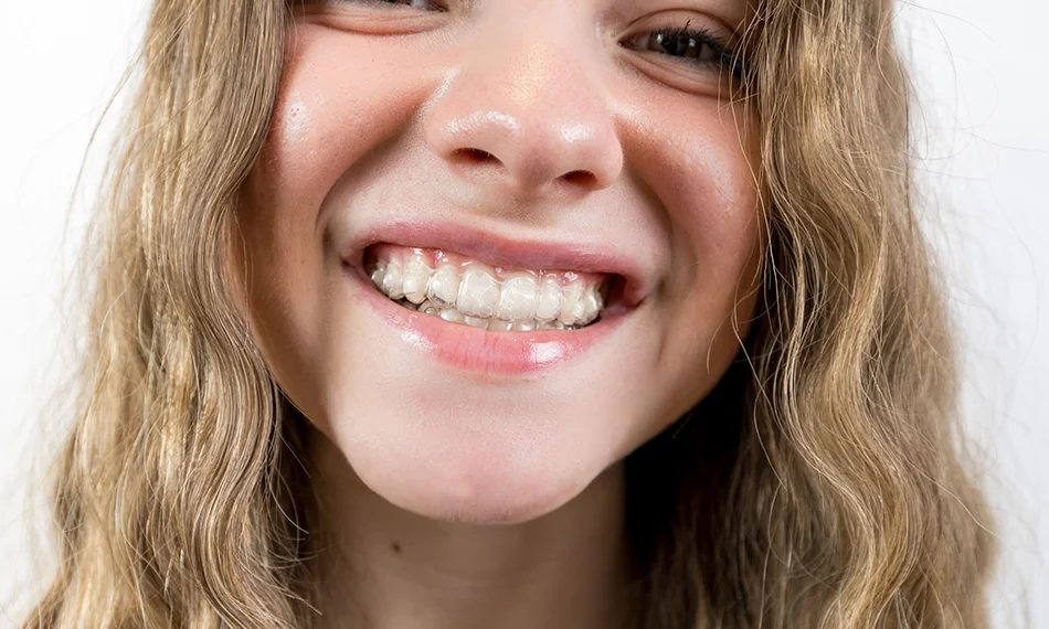 Ortodoncija za djecu