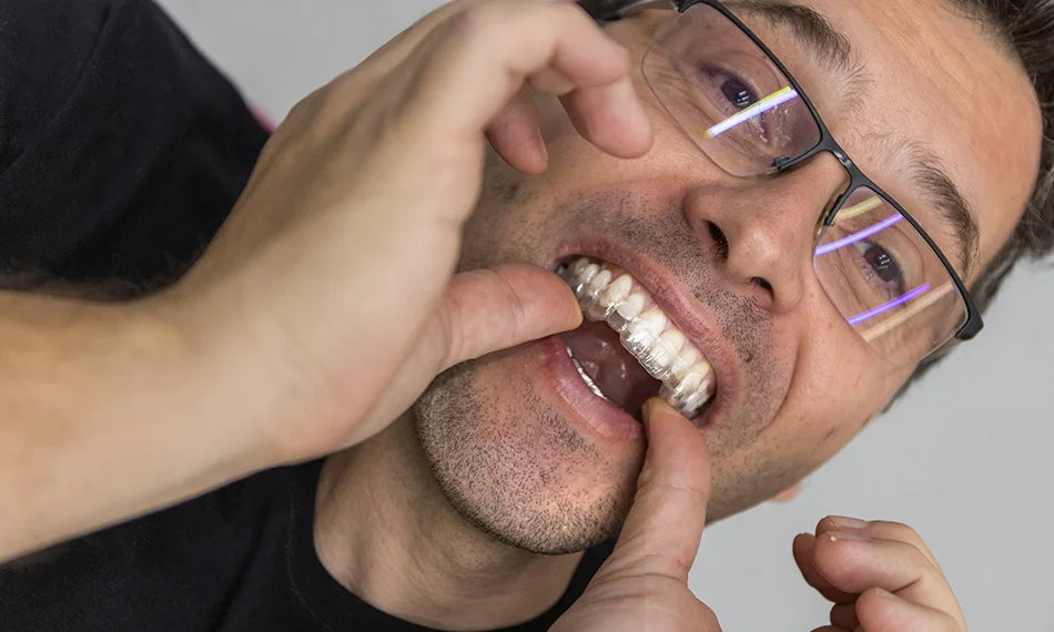 Ortodonacija za odrasle