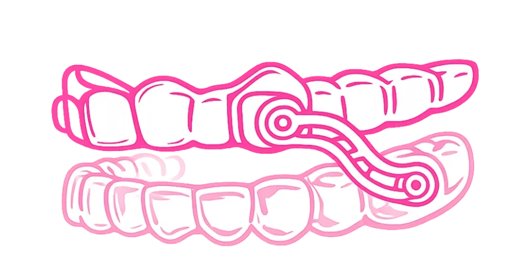 diskretno i jednostavno rjesenje sl1