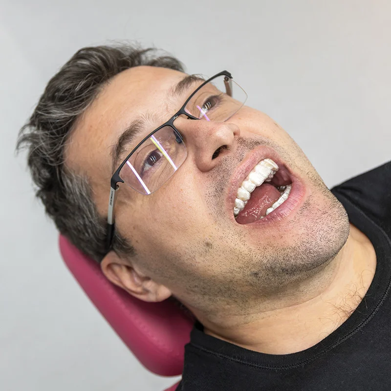 odrasli ortodoncija nas mob sl1