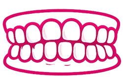 pretjerana zbijenost pr sl1