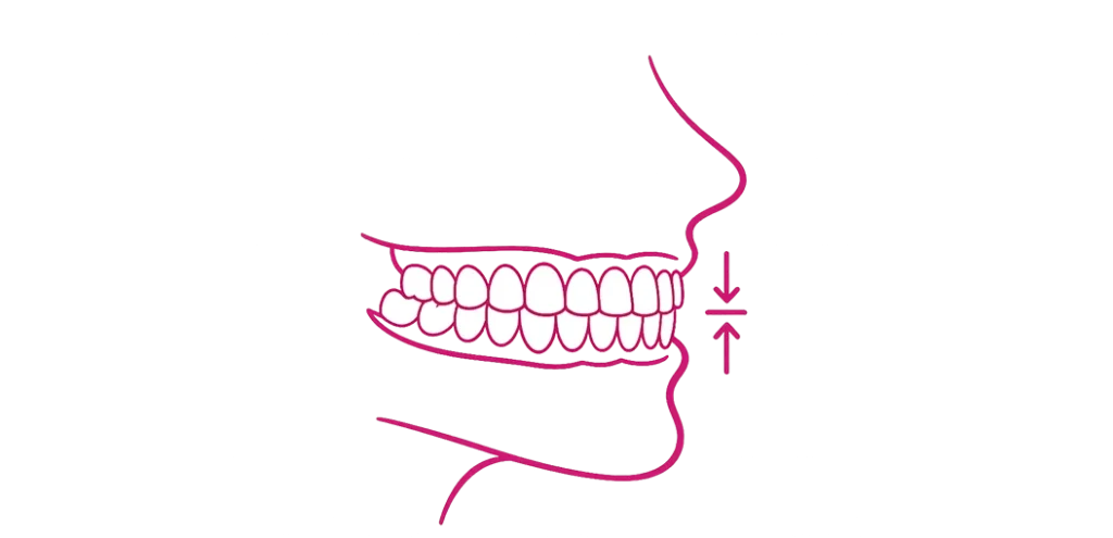 temporomandibularna4